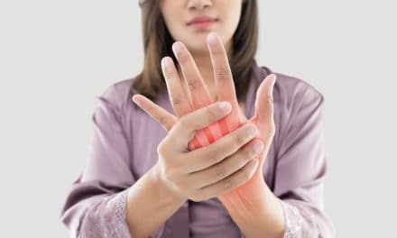 Artritis šake – uzrok, simptomi i liječenje
