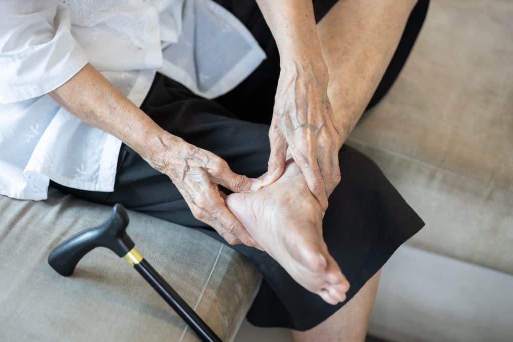 Artritis stopala - uzrok, simptomi i liječenje