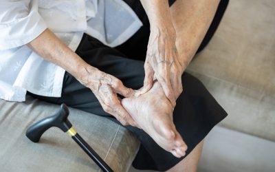 Artritis stopala – uzrok, simptomi i liječenje