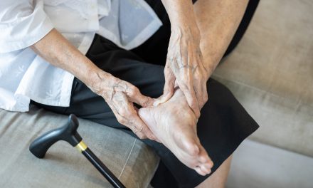 Artritis stopala – uzrok, simptomi i liječenje
