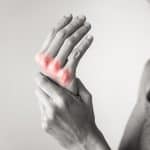 Artroza prstiju ruke – uzrok, simptomi i liječenje
