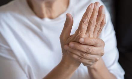 Artroza šaka – uzrok, simptomi i liječenje