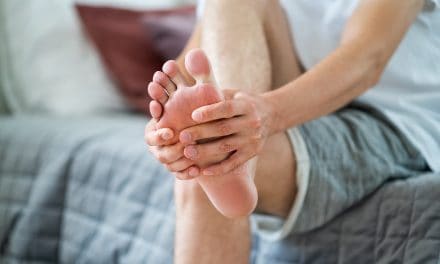 Artroza stopala – uzrok, simptomi i liječenje