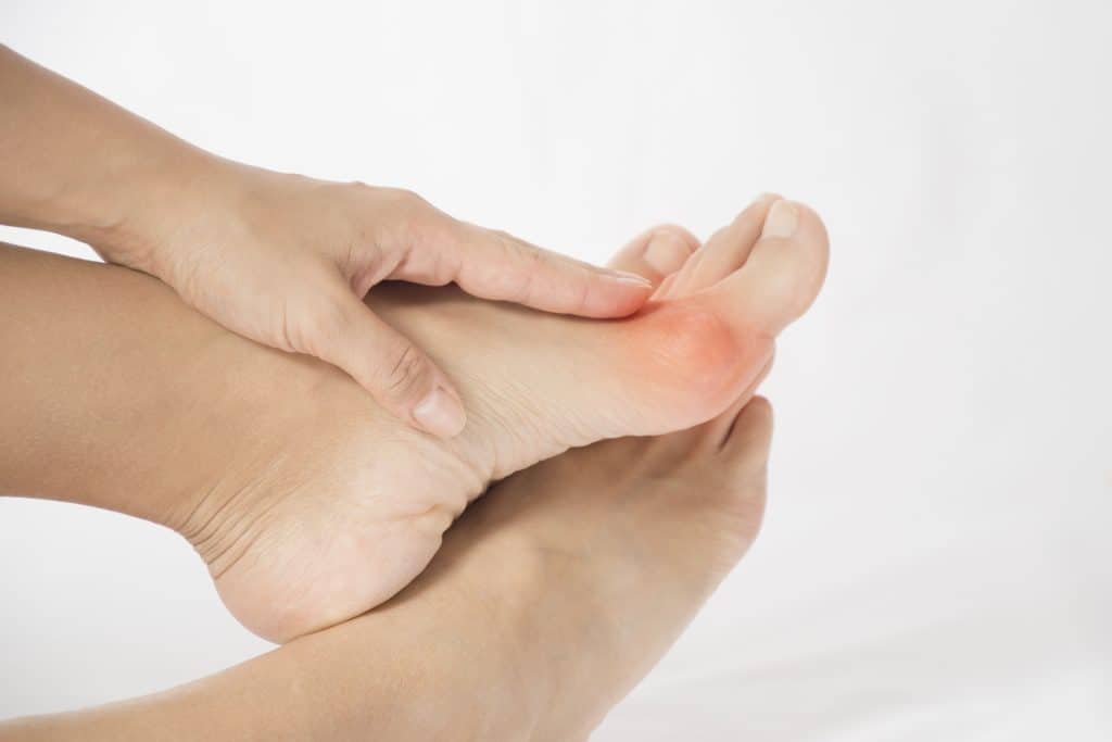 Deformacija prstiju na nogama - uzrok, simptomi, liječenje