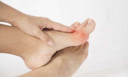 Deformacija prstiju na nogama – uzrok, simptomi, liječenje