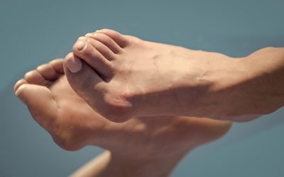 Deformiteti stopala – uzrok, simptomi, liječenje