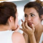 Gnojne bubuljice na licu – uzrok, simptomi, liječenje