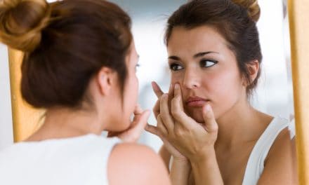 Gnojne bubuljice na licu – uzrok, simptomi, liječenje