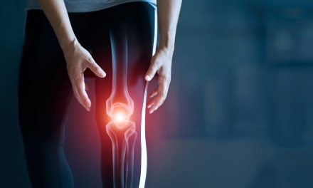 Osteoartroza – uzrok, simptomi i liječenje