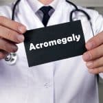 Akromegalija – uzrok, simptomi, liječenje