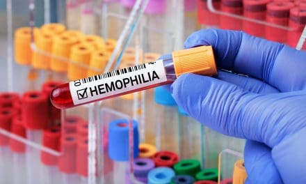 Hemofilija – uzrok, simptomi, liječenje