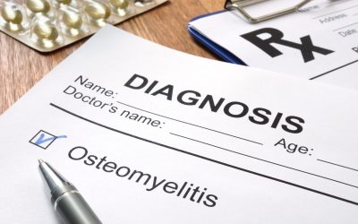 Osteomijelitis – uzrok, simptomi, liječenje
