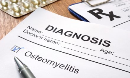 Osteomijelitis – uzrok, simptomi, liječenje