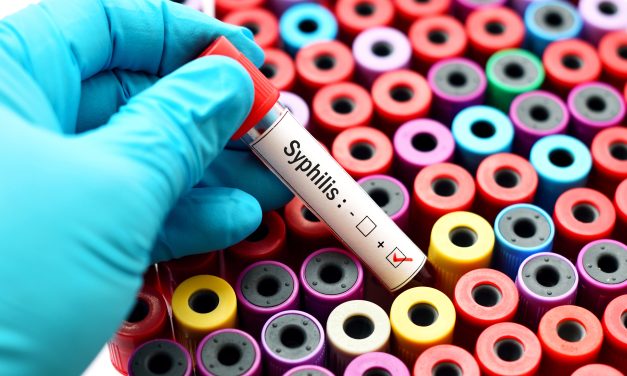 Sifilis – uzrok, simptomi, liječenje