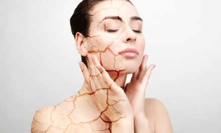 Suha koža – čime je liječiti?