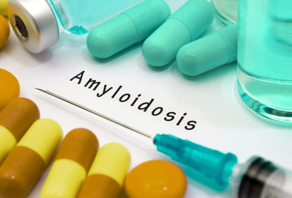 Amiloidoza - uzrok, simptomi, liječenje