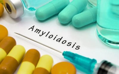 Amiloidoza – uzrok, simptomi, liječenje