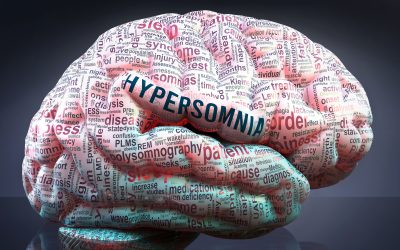 Hipersomnija – uzrok, simptomi, liječenje