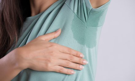 Prekomjerno znojenje – uzrok, simptomi, liječenje