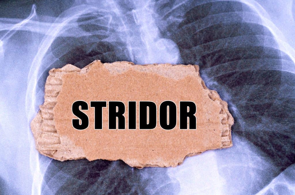 Stridor - uzrok, simptomi, liječenje