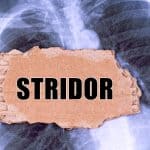Stridor – uzrok, simptomi, liječenje