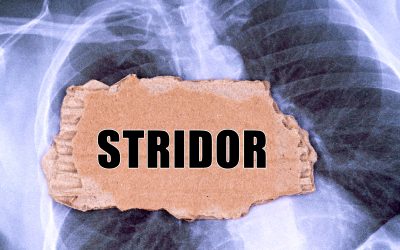 Stridor – uzrok, simptomi, liječenje