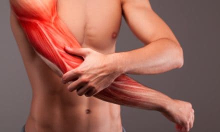 Bolni mišić leđa – uzrok, simptomi, liječenje