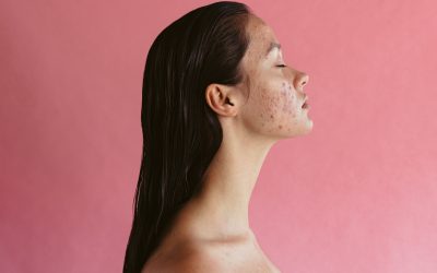Dermatološko – kozmetički problemi u ginekološkoj ambulanti