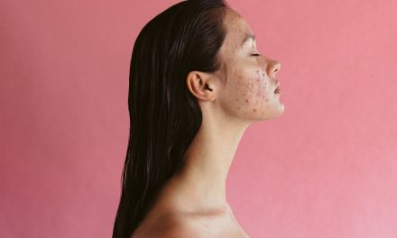 Dermatološko – kozmetički problemi u ginekološkoj ambulanti