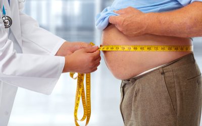 Gojaznost – uzrok, simptomi, liječenje