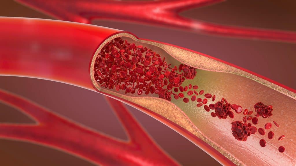 Jačanje krvnih žila