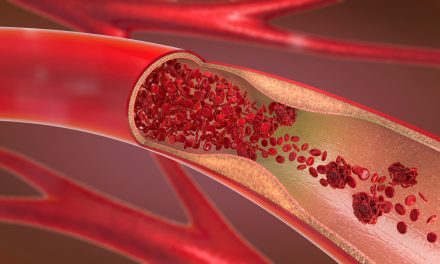 Jačanje krvnih žila