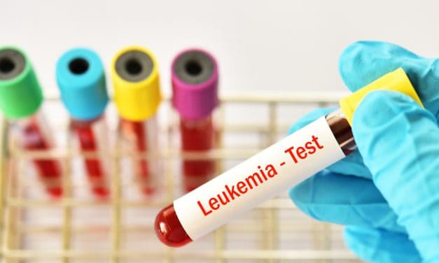 Kronična limfocitna leukemija – uzrok, simptomi, liječenje