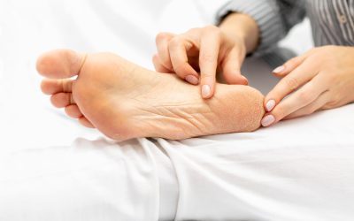 Perutanje kože na nogama – uzrok, simptomi, liječenje