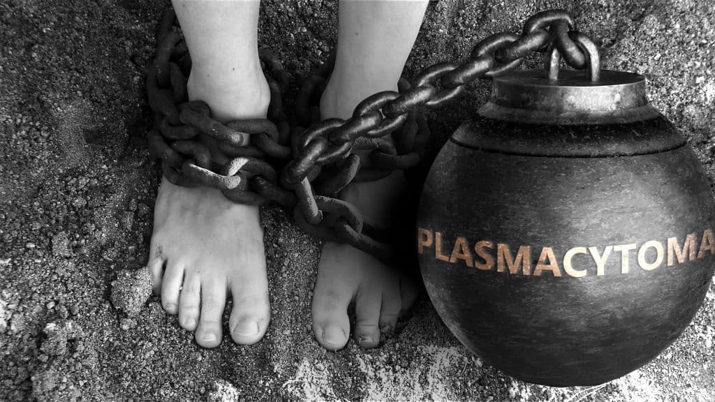 Plazmocitom - uzrok, simptomi, liječenje