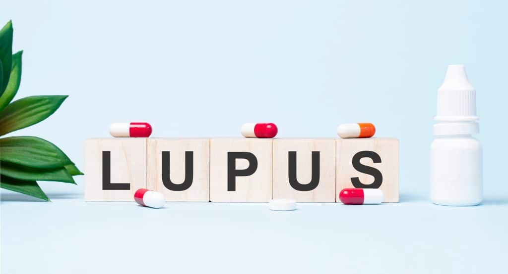 Sistemski eritemski lupus - uzrok, simptomi, liječenje