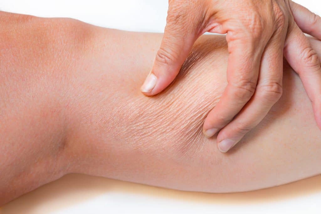 Suha koža na nogama - uzrok, simptomi, liječenje
