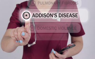 Addisonova bolest – uzrok, simptomi, liječenje