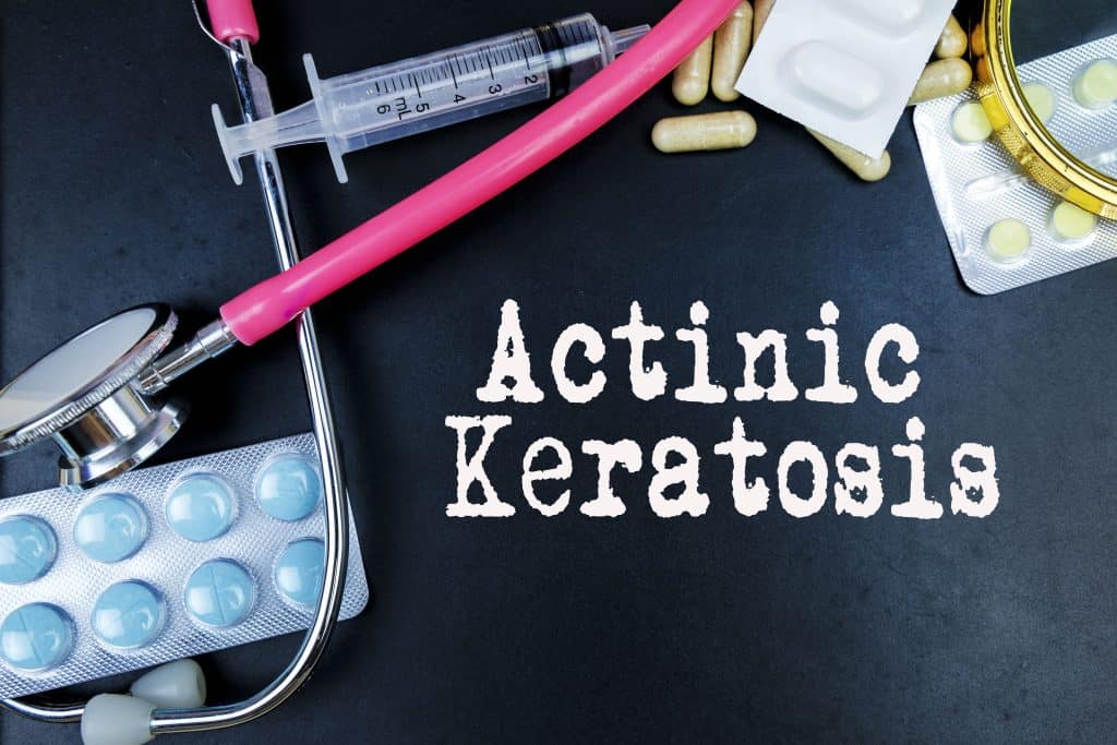 Aktinička keratoza - uzrok, simptomi, liječenje
