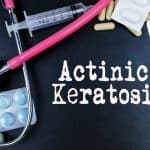 Aktinička keratoza – uzrok, simptomi, liječenje