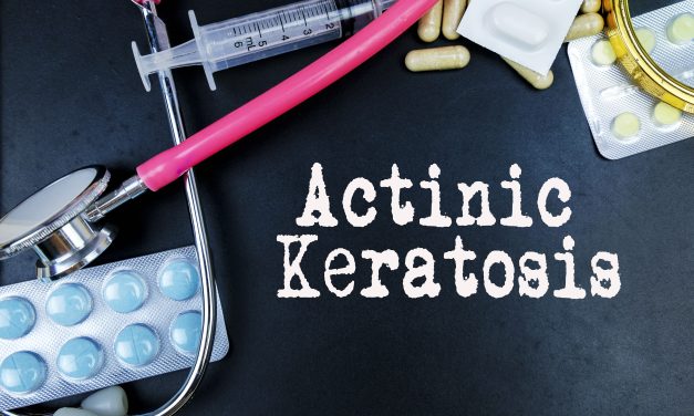 Aktinička keratoza – uzrok, simptomi, liječenje