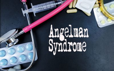 Angelmanov sindrom – uzrok, simptomi, liječenje