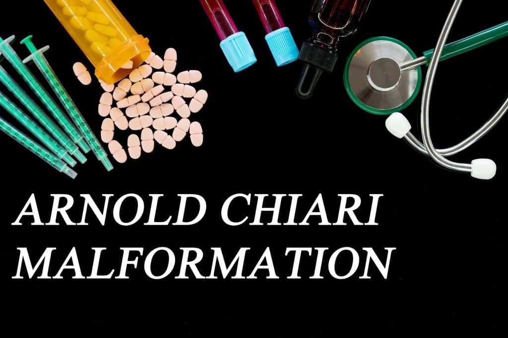 Arnold-Chiarijeva malformacija - uzrok, simptomi, liječenje