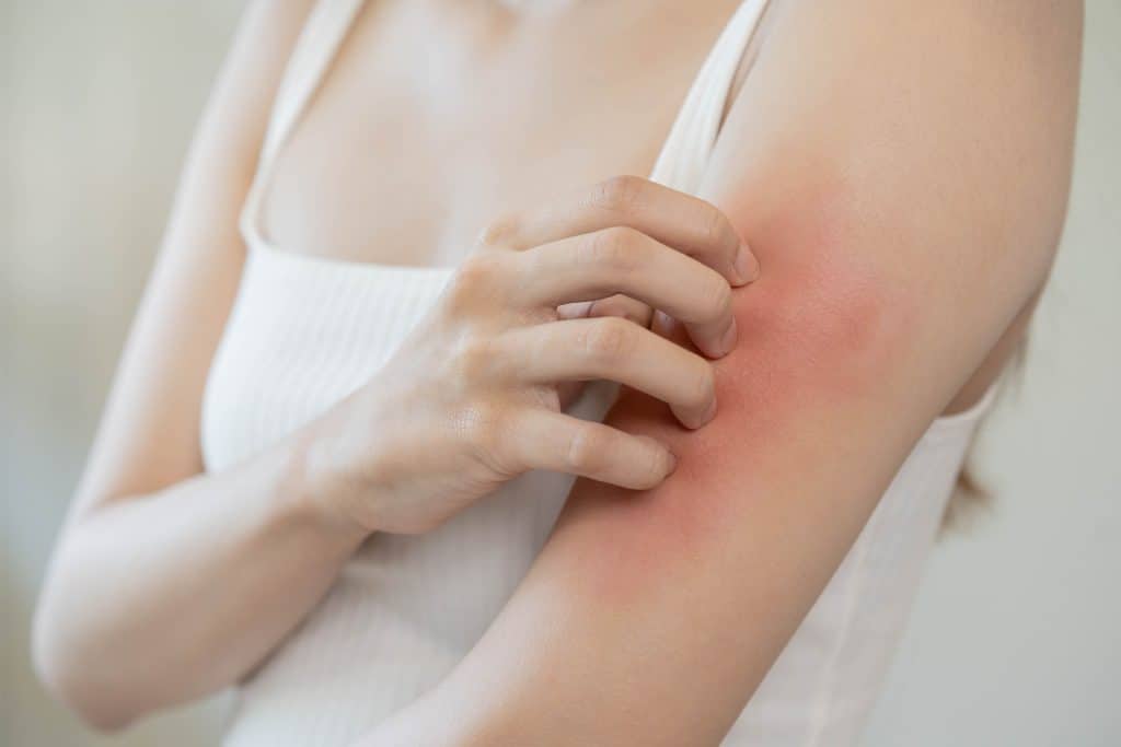 Crvenilo i svrbež kože - uzrok, simptomi, liječenje