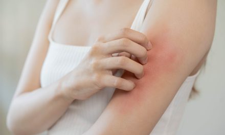 Crvenilo i svrbež kože – uzrok, simptomi, liječenje