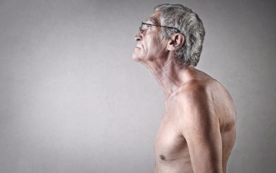Grba na leđima – uzrok, simptomi, liječenje