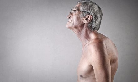 Grba na leđima – uzrok, simptomi, liječenje