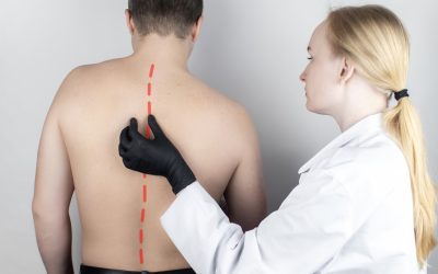 Grbava leđa – uzrok, simptomi, liječenje