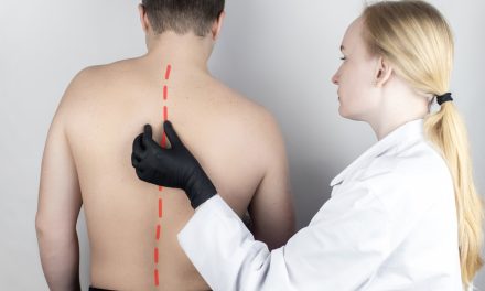 Grbava leđa – uzrok, simptomi, liječenje