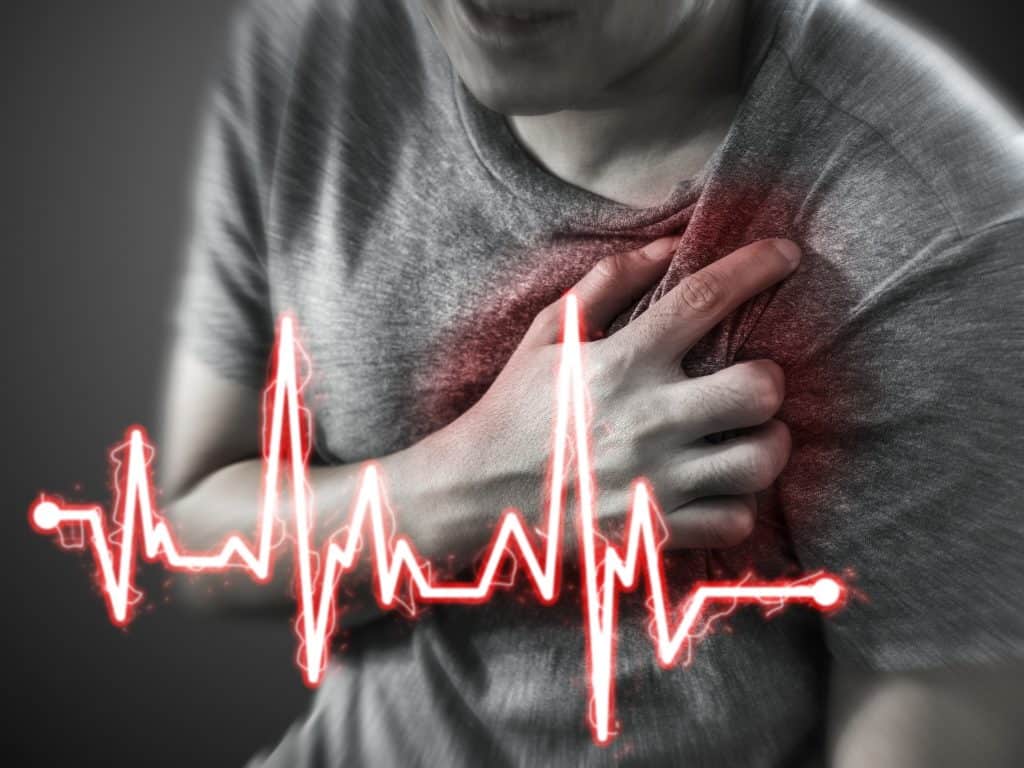 Srčani infarkt - uzrok, simptomi, liječenje